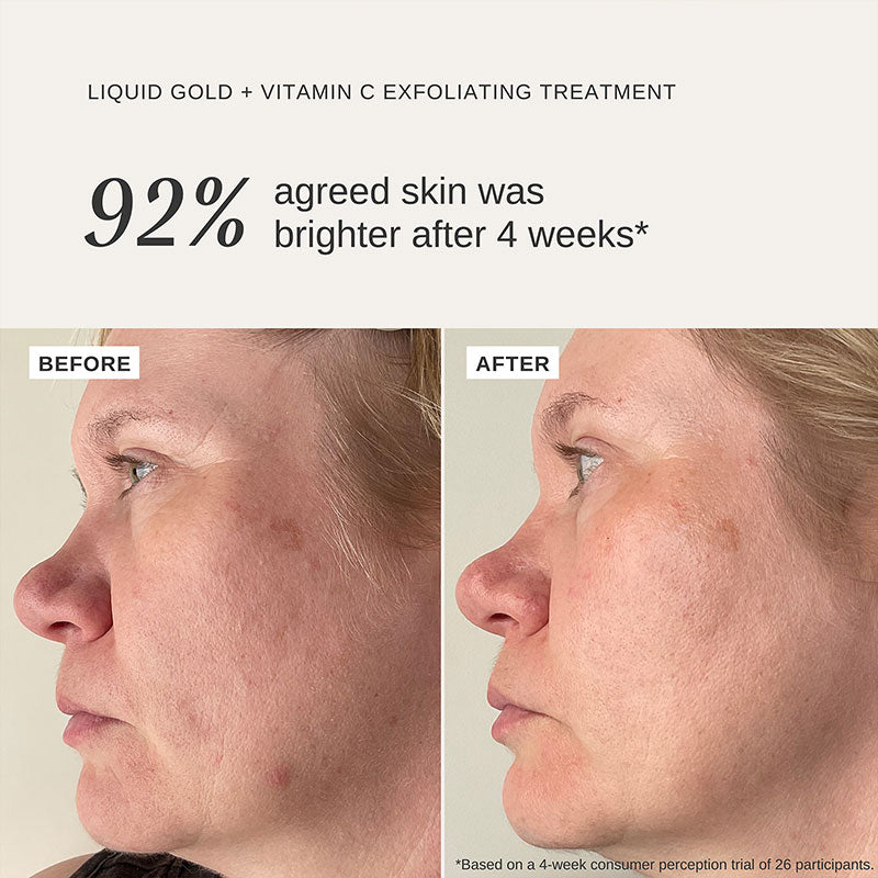 Alpha-H Liquid Gold + Vitamin C 100ml