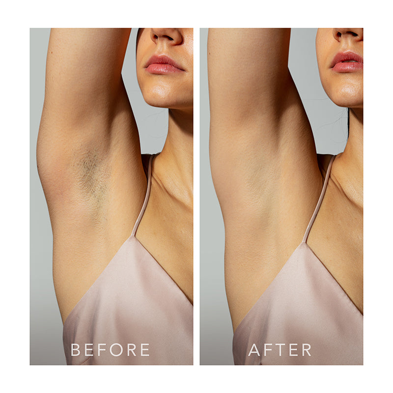 FOREO PEACH 2 Peach