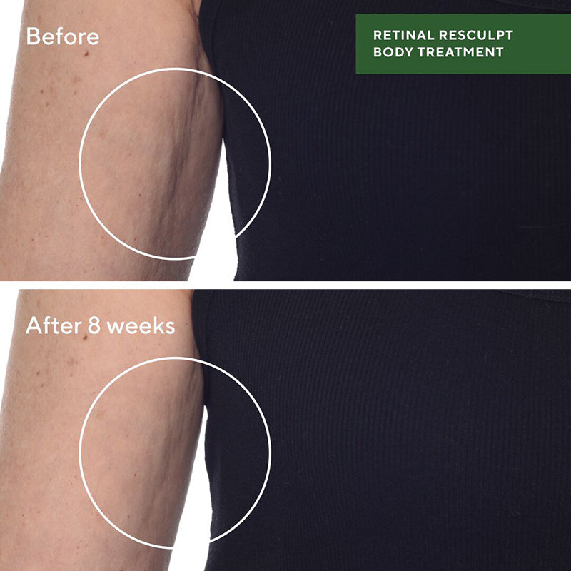 Murad Retinal ReSculpt Body Treatment 148ml