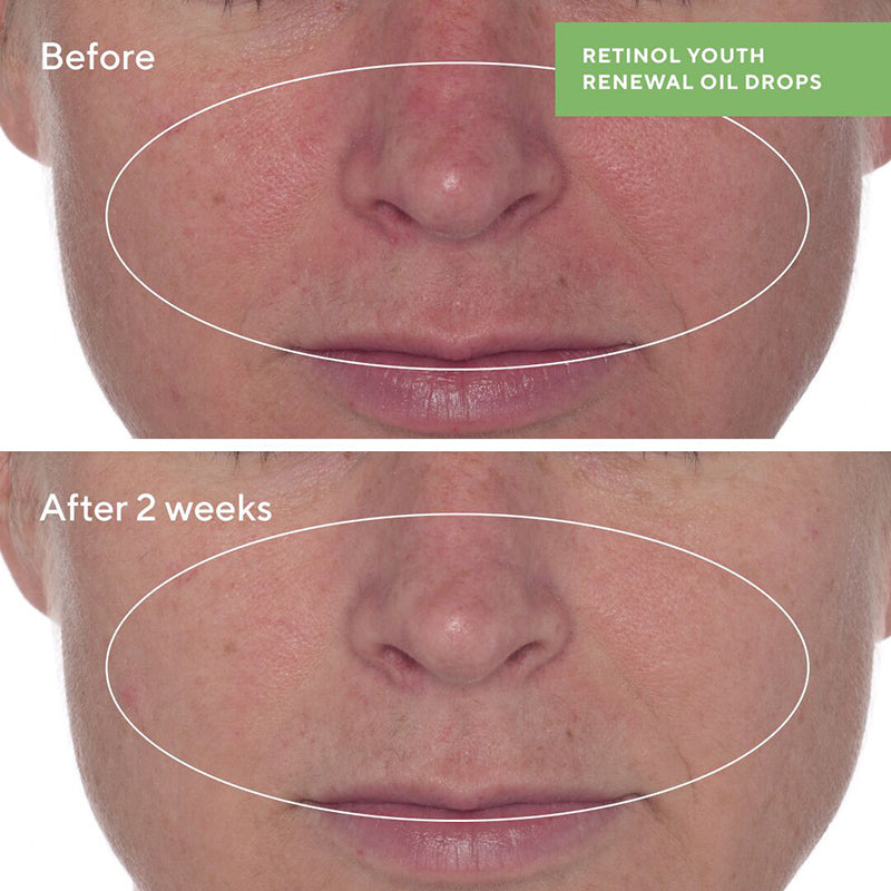 Murad Retinol Youth Renewal Oil Drops 30ml