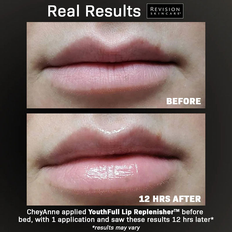 Revision YouthFull Lip Replenisher 9.4g